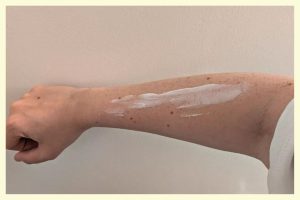 Moisturizing and Sun Protection for Post-Treatment Care